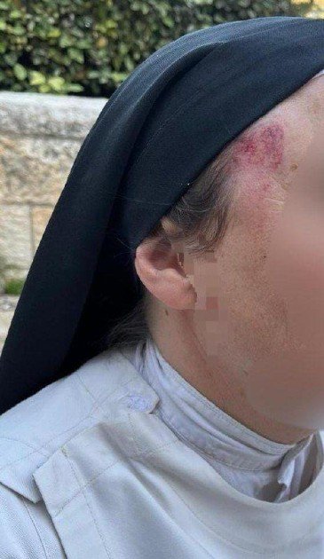 إصابة راهبة باعتداء مستعمر في القدس المحتلة