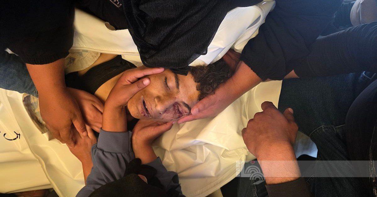 ارتفاع حصيلة الشهداء في قطاع غزة إلى 72,612 والإصابات إلى 172,457 منذ بدء العدوان