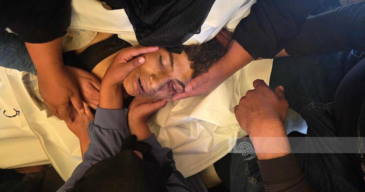 ارتفاع حصيلة الشهداء في قطاع غزة إلى 72,619 والإصابات إلى 172,484 منذ بدء العدوان